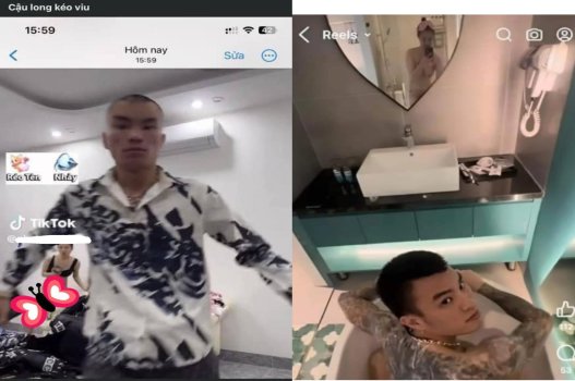 Vợ long to 9 ngón lộ bướm rậm lông